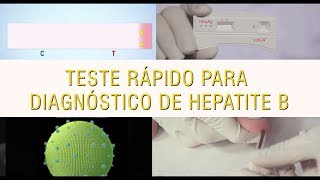 Teste rápido para o diagnóstico da Hepatite B VIKIA HBsAg [upl. by Dikmen]