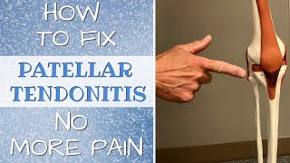 How To Fix Patellar Tendonitis No More Pain amp Self Treatment [upl. by Dauf]