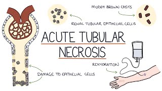 Understanding Acute Tubular Necrosis [upl. by Enra]