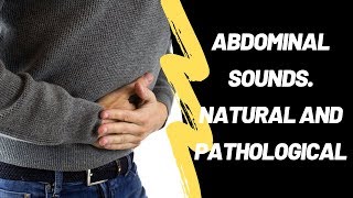 Abdominal Sounds Natural And Pathological [upl. by Scammon]