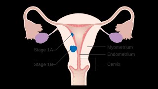 Ciclo menstrual ovárico y endometrial [upl. by Aneeras15]