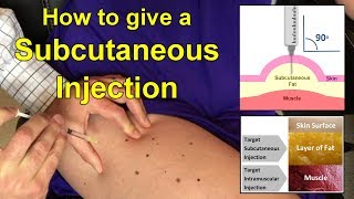 How to Give a Subcutaneous Injection Video [upl. by Elletnuahc]