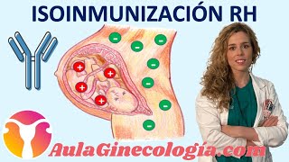 ISOINMUNIZACIÓN RH GAMMAGLOBULINA ANTIG VACUNA TRATAMIENTO  Ginecología y Obstetricia [upl. by Settle107]