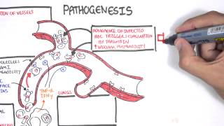 Malaria Pathophysiology [upl. by Bartolome]