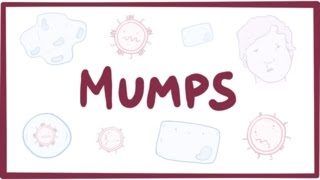 Mumps  symptoms diagnosis treatment pathology [upl. by Cynthla]