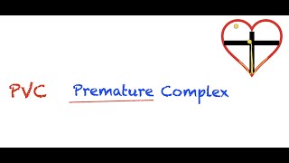 Premature Ventricular Contractions PVC Interpretation Easy and Simple [upl. by Ragouzis]