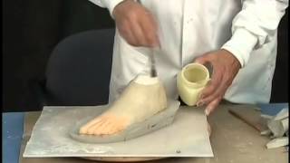 Custom Fabrication of A Silicone Partial Foot Prosthesis [upl. by Hen]