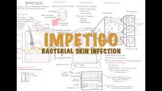 Impetigo Bacterial Skin Infection  Overview Clinical Presentation Pathophysiology Treatment [upl. by Brownson]